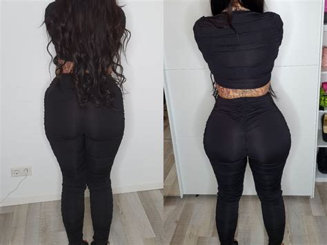 Woman who spent $215,000 on butt lift still cant get a date